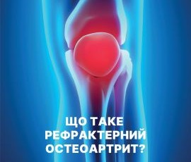 Остеоартрит колінного суглоба: новий препарат KioMedinevsone для лікування ін’єкціями у коліно