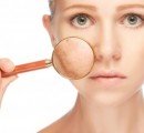 Врачи рассказали, стоит ли бояться пигментации кожи