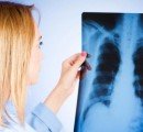 Врачи рассказали, как защититься от туберкулеза