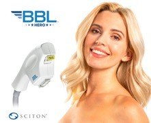 HERO BBL - новая технология фотоомоложения