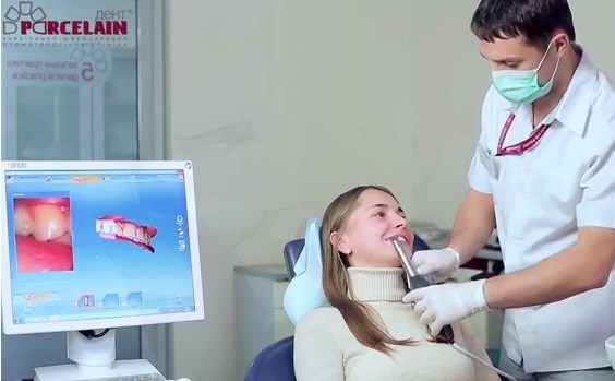 Процедура сканирования зубов с помощью системы Cerec OmniCam