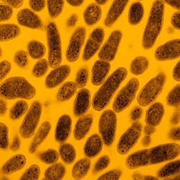 Gardnerella vaginalis Gardnerella vaginalis