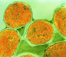 Mycobacterium leprae 