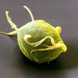 Trichomonas vaginalis